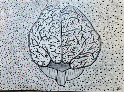 Brain scan