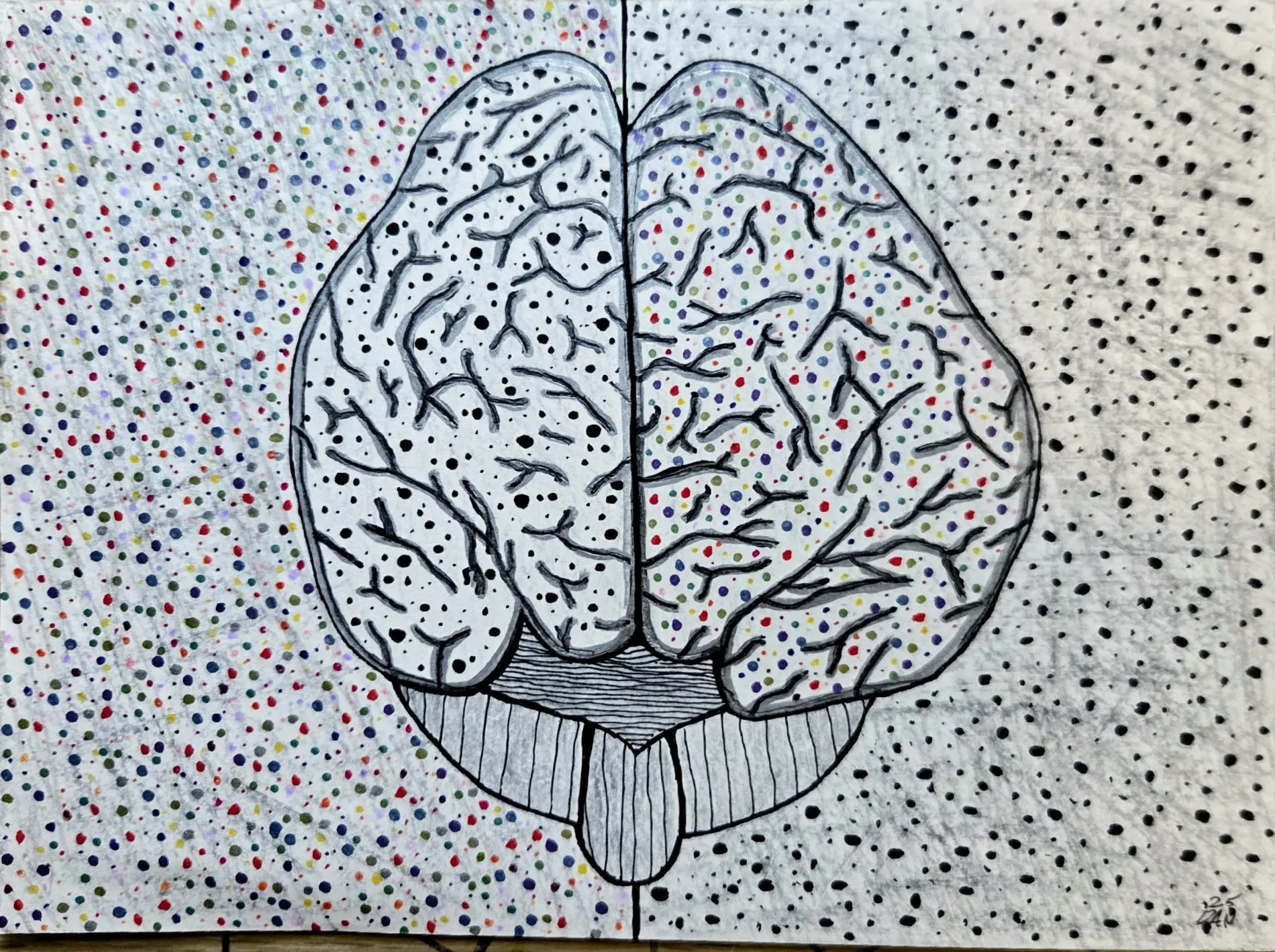 Brain scan